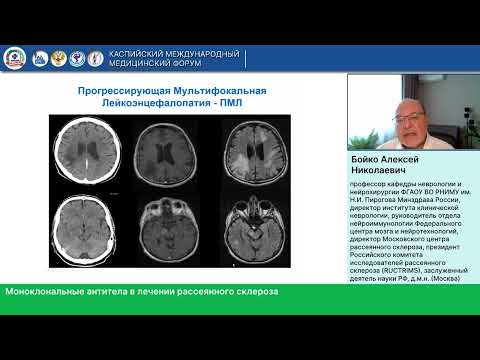 Видео: Бойко А.Н. Моноклональные антитела в лечении рассеянного склероза