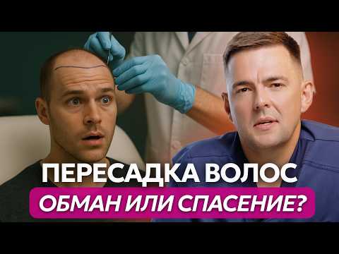 Видео: Пересадка волос: кому поможет, а кому нет? Все за и против