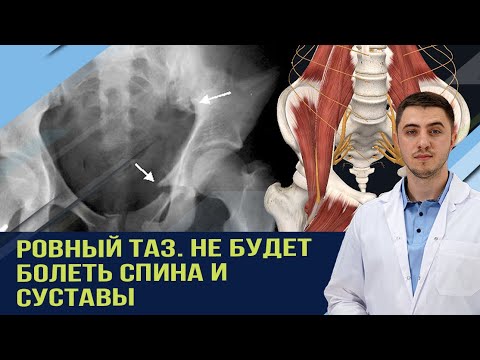 Видео: Быстро убрать перекос таза и боль в пояснице. чтоб закрепить эффект используйте