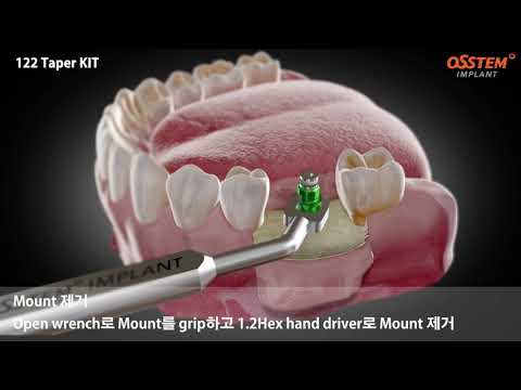 Видео: 122 Taper Kit.  Хирургический протокол