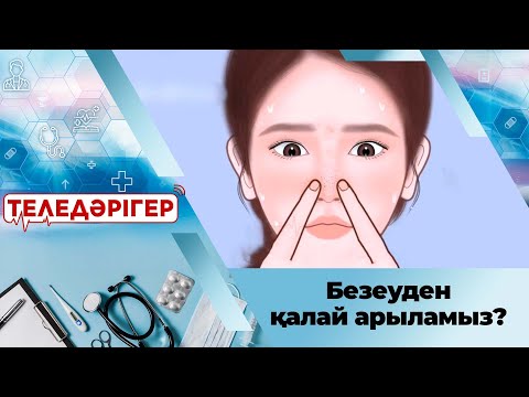 Видео: Безеуден қалай арыламыз? І «Теледәрігер»