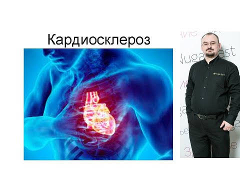Видео: Кардиосклероз – проявление и лечение.