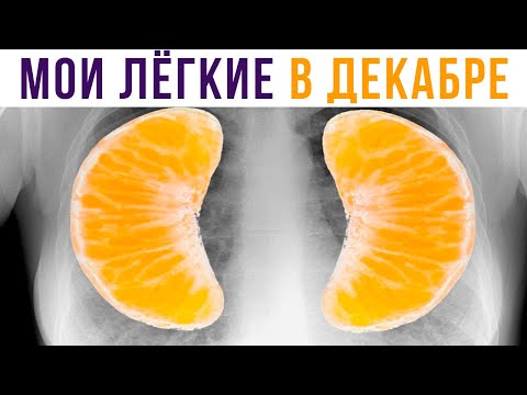 Видео: МОИ ЛЁГКИЕ В ДЕКАБРЕ))) Приколы | Мемозг #524