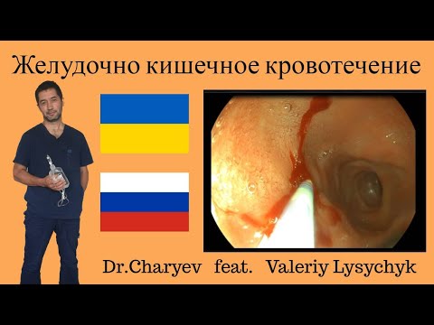 Видео: Желудочно кишечное кровотечение.