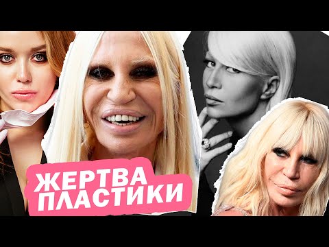 Видео: Мнение КОСМЕТОЛОГА: ДОНАТЕЛЛА ВЕРСАЧЕ - УСТАЛЫЙ ТИП и РАДИКАЛЬНАЯ ПЛАСТИКА