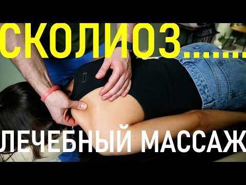 Видео: Массаж при СКОЛИОЗЕ позвоночника. Как исправить сколиоз 1 и 2 степени