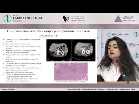 Видео: Есть ли корреляция между радиологическим и клиническим ответами на иммунотерапию? (Оганесян А.П.)