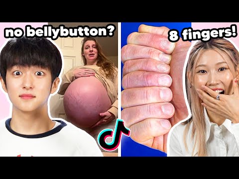 Видео: КОРЕЙЦЫ РЕАГИРУЮТ НА РЕДЧАЙШИЕ ЧЕРТЫ, КОТОРЫЕ ЕСТЬ ТОЛЬКО У 1% ЛЮДЕЙ! | PEACH