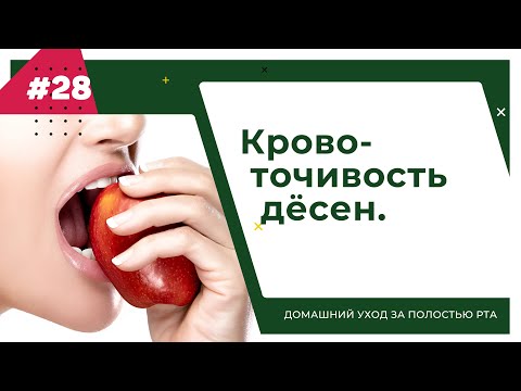 Видео: Кровоточивость дёсен. Урок №28 - ДОМАШНИЙ УХОД ЗА ПОЛОСТЬЮ РТА.