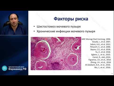 Видео: Рак мочевого пузыря.  Современные методы диагностики и лечения. (д.м.н. Гаджиев Н.К.)