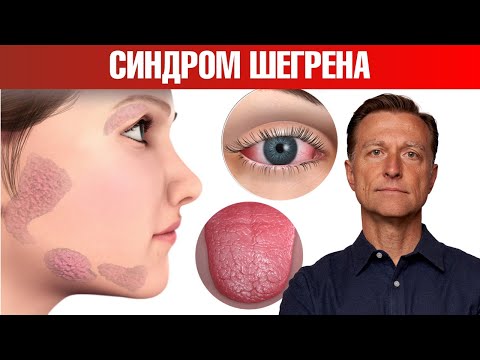Видео: Самый эффективный протокол при синдроме Шегрена✅