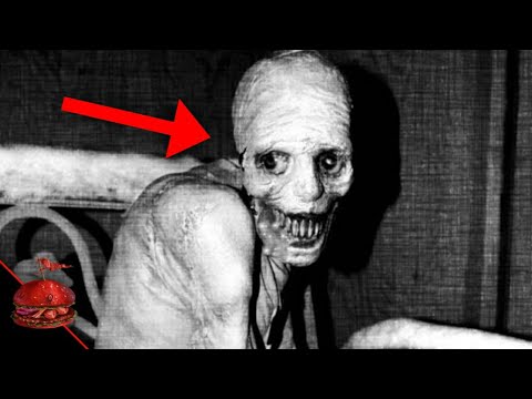 Видео: Бага насны Trauma-нууд (Part 4)