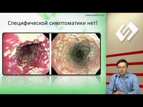 Видео: Паразитарные инвазии  Грибковые инфекции