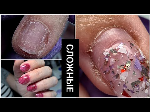 Видео: СЛОЖНЫ ногти 