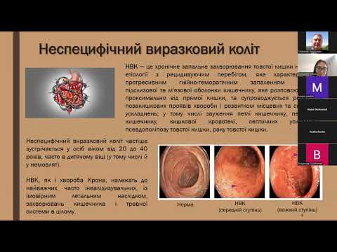 Видео: Рибіна Єлизавета (2024). Етрасімод (Etrasimod)