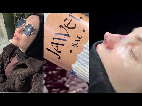 Видео: Ринопластика в Стамбуле😍 JAWEL платки. Обзор цен. Первый весенний влог🥰
