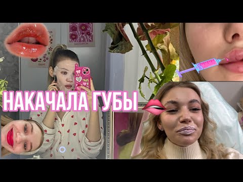 Видео: ВЛОГ | НАКАЧАЛА ГУБЫ| ОЧЕНЬ ПЕРЕЖИВАЮ | ИДУ НА ЖЕНСКОЕ МЕРОПРИЯТИЕ|