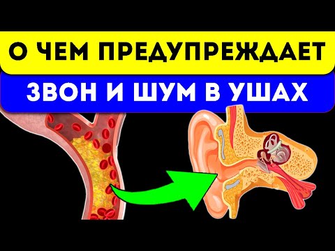 Видео: 3 капли за ужином и прошел звон в ушах и голове
