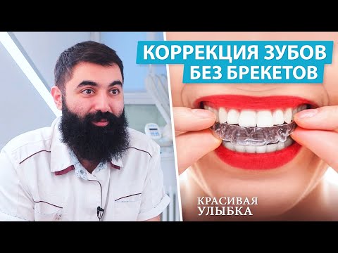 Видео: Элайнеры — когда и для чего применяют | Выравнивание зубов
