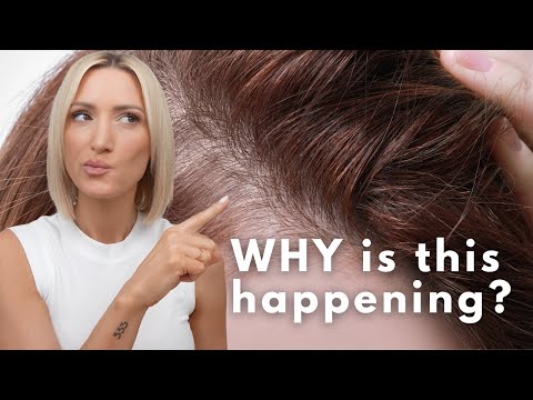 Видео: 10 самых часто задаваемых вопросов о тонких/редких волосах (с ответами!)