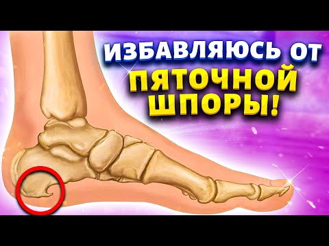 Видео: Делаю это на ночь и забыла о пяточной шпоре. Плантарный фасциит. Больные ноги превращает в здоровые.