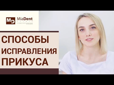 Видео: 🤔 Что выбрать для исправления прикуса: брекеты или капы. Брекеты или капы. 12+