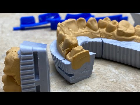 Видео: СИСТЕМА ТОЧНЫХ МОДЕЛЕЙ. Методы заливки .  Зубной техник.Видео курс