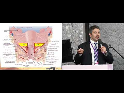 Видео: Ультраконсервативное лечение рака шейки матки I стадии