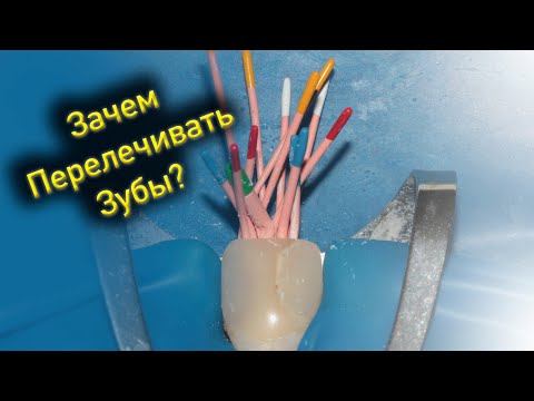 Видео: Зачем перелечивать зубы?