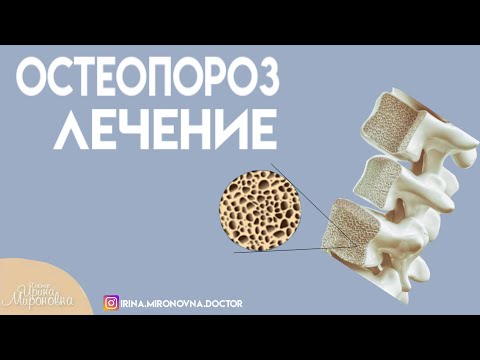 Видео: Остеопороз. Лечение.