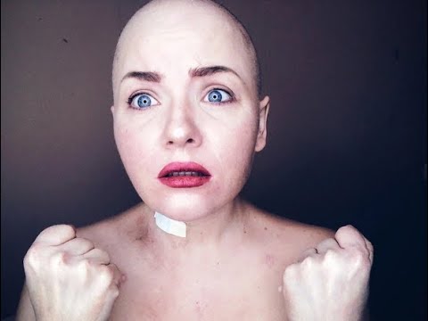 Видео: Стефания: "РАК КРОВИ помог жить лучше"