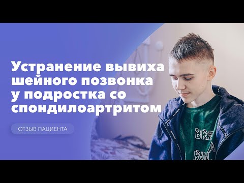 Видео: Устранение  вывиха шейного позвонка у подростка с ювенильным спондилоартритом. Отзыв пациента