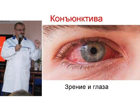 Видео: Конъюнктива и конъюнктивит.