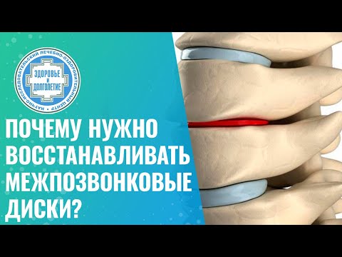 Видео: 👉 Почему нужно восстанавливать межпозвонковые диски?