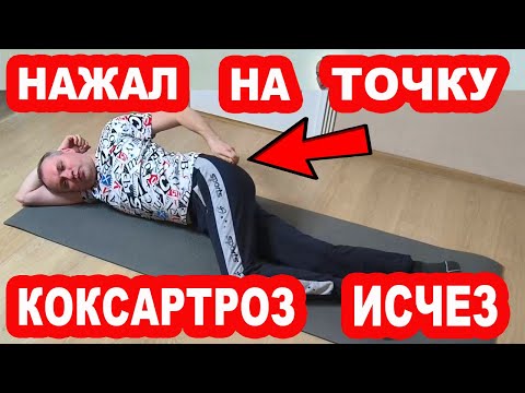 Видео: Нажми на эту Точку и КОКСАРТРОЗА не будет НИКОГДА! Врачи это от нас Скрывают