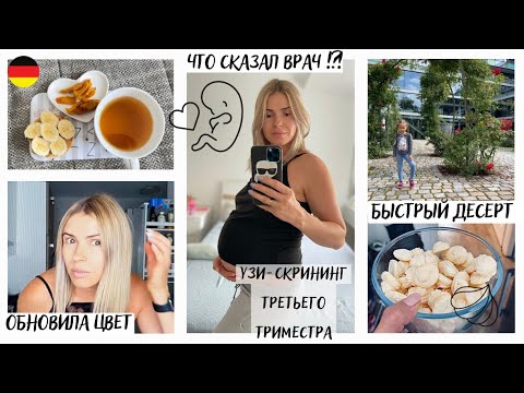 Видео: ВЛОГ: УЗИ - скрининг 3 триместра / БЕРЕМЕННОСТЬ 31 НЕДЕЛЯ/ что сказал врач / тянет на сладкое