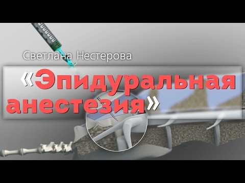 Видео: Эпидуральная анестезия. Epidural Anesthesia