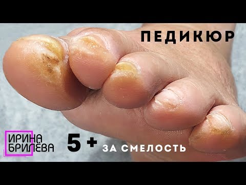 Видео: ПРЕОБРАЖЕНИЕ педикюр 😱 Возрастные ножки тоже хотят красоты