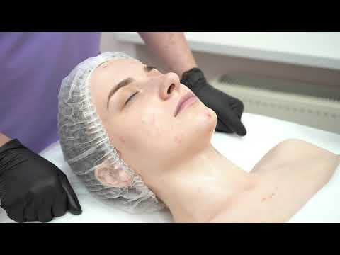 Видео: Комплексная процедура: Сферогель, Cellviderm, Мезофакторы