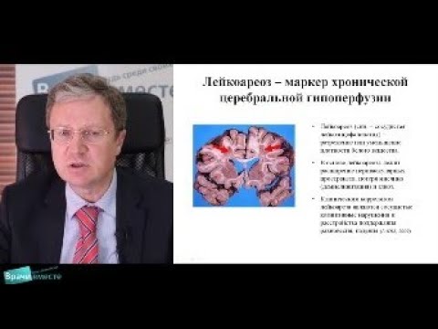 Видео: Вебинар «Ведение больного с ХИМ: На что обратить внимание?»