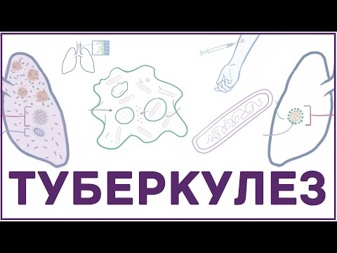 Видео: Туберкулез - микобактерия, симпмтомы, патофизиология, диагностика, лечение