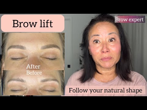 Видео: Подтяжка бровей