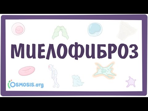 Видео: Миелофиброз — причины, симптомы, патогенез, диагностика, лечение