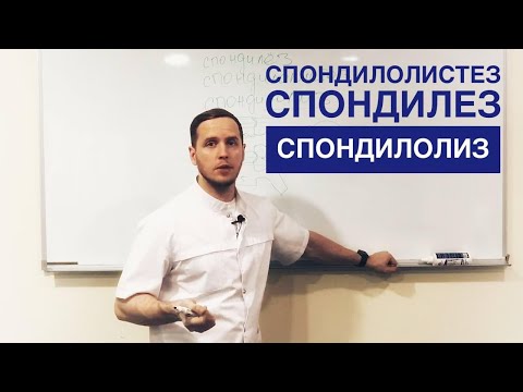 Видео: Спондилолистез, спондилолиз, спондилёз