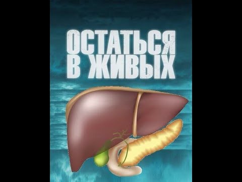 Видео: Портальная гипертензия