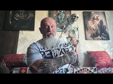 Видео: Все не просто с коксартрозом! Прямая мышца или подвздошная?