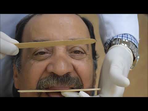 Видео: Полный клинический съемный протез PRS 412. Регистрация прикуса.