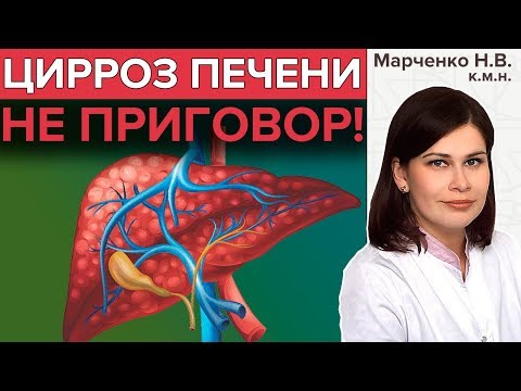 Видео: ЦИРРОЗ ПЕЧЕНИ: Признаки, лечение | Что такое цирроз печени?