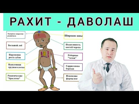 Видео: РАХИТ ДАВОСИ УЙ ШАРОИТИДА