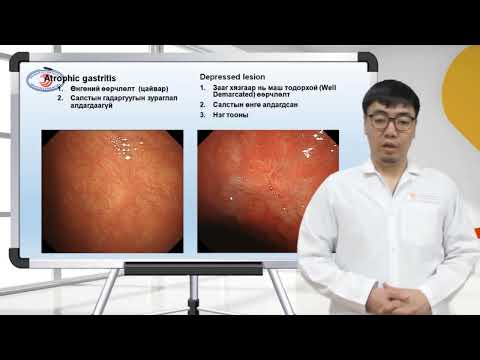 Видео: Ходоодны ХХ ын дурангийн илрүүлэг